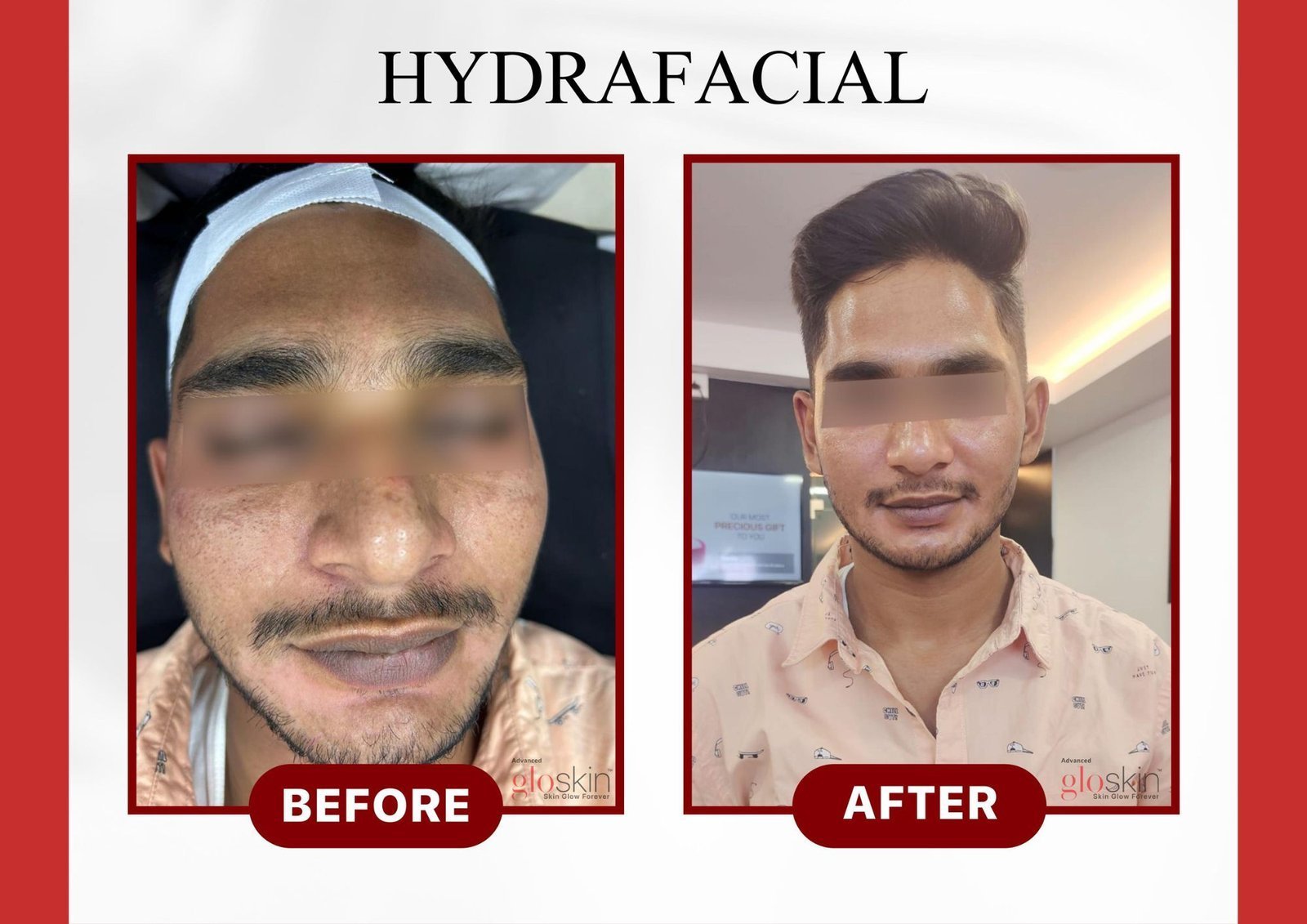 Hydrafacial.jpg