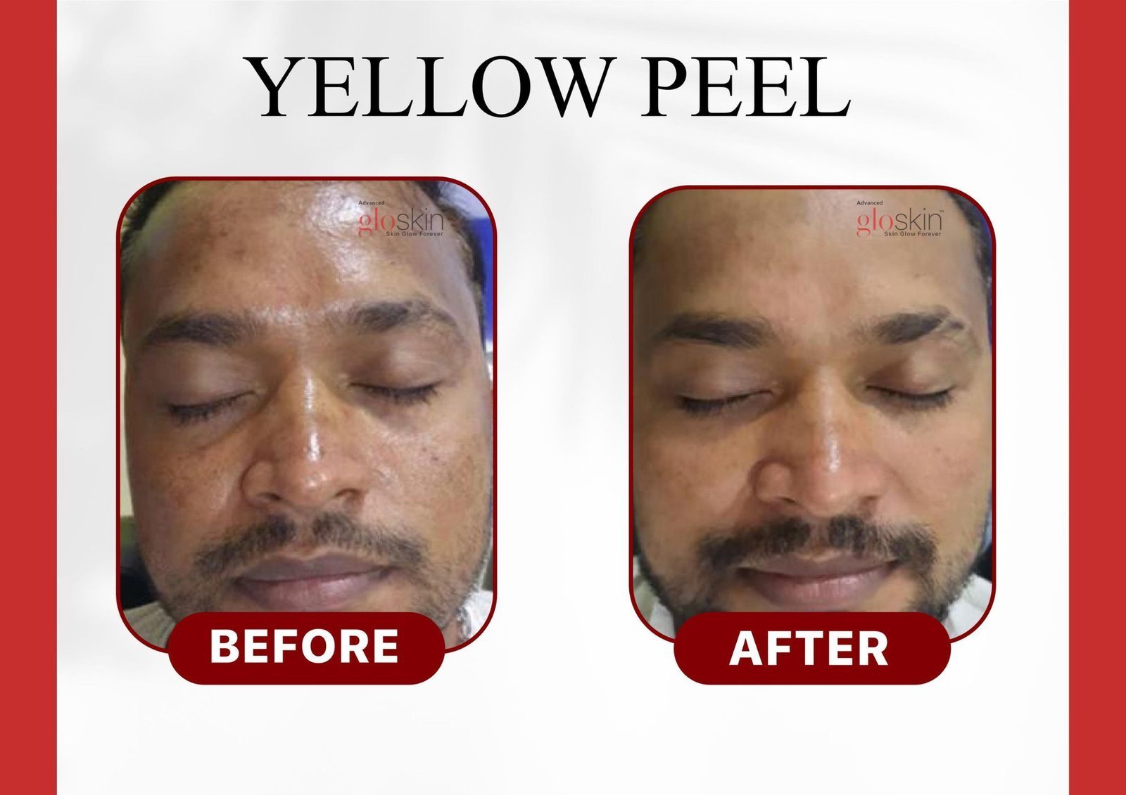 Yellow-Peel.jpg