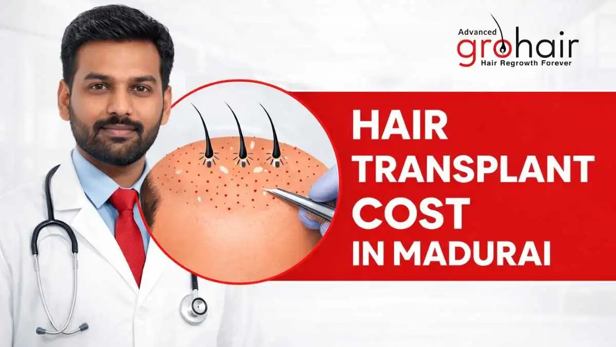 Hair Transplant Cost in Madurai