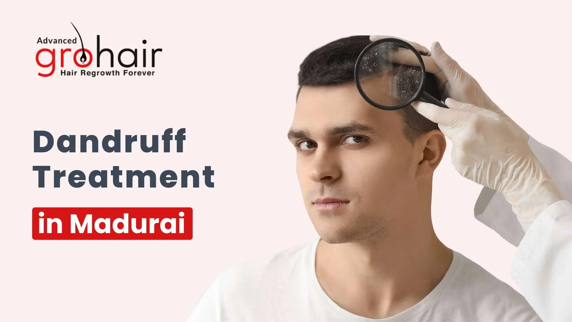 Dandruff Treatment in Madurai