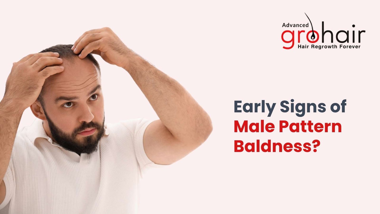 Early Signs of Male Pattern Baldness